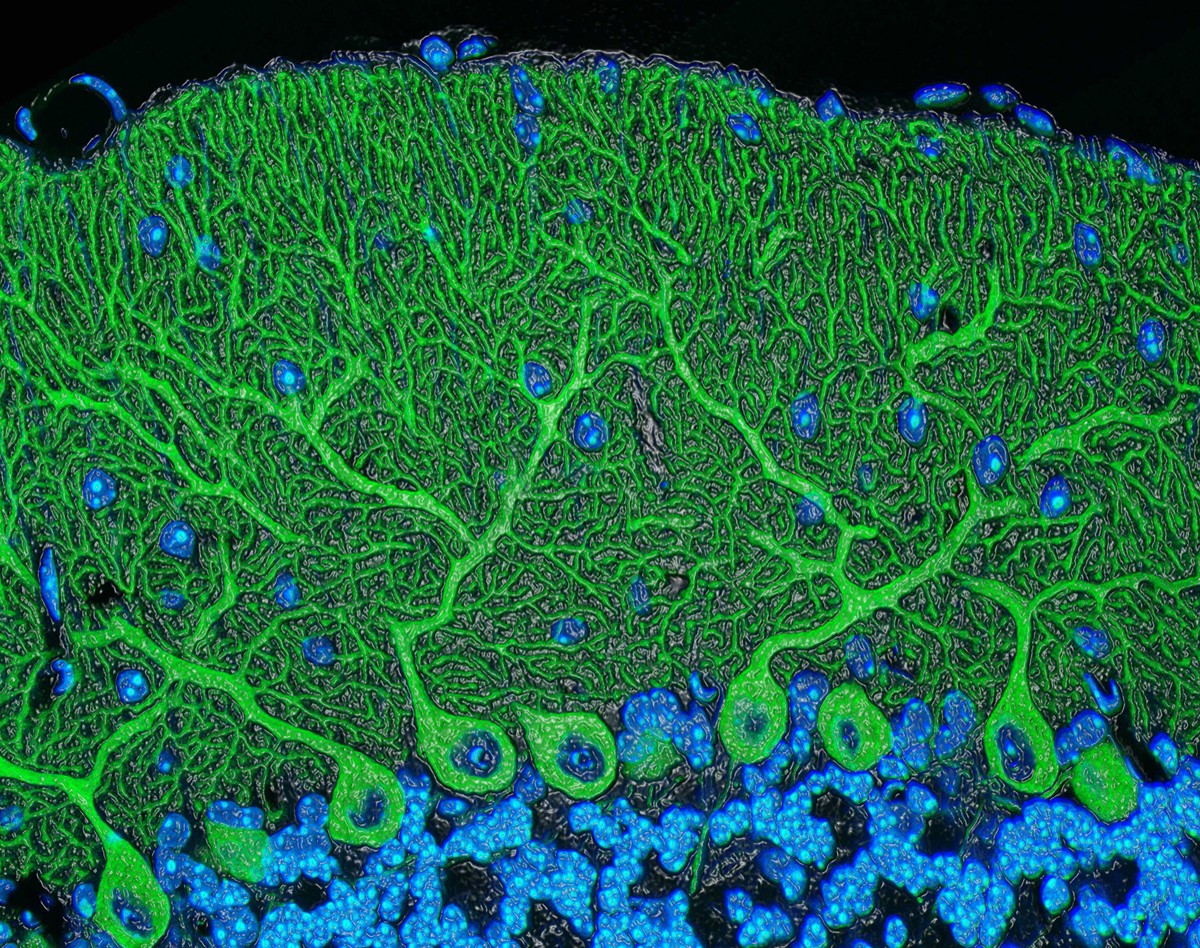 Mouse cerebellum | National Institute of General Medical Sciences